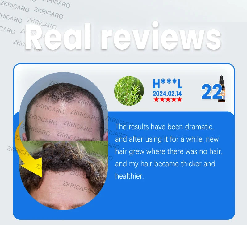 Rosemary Hair Growth Serum Anti Hair Loss Prevent Baldness Hair Care Essential Oil Scalp Treatment Beauty Health Care Men Women