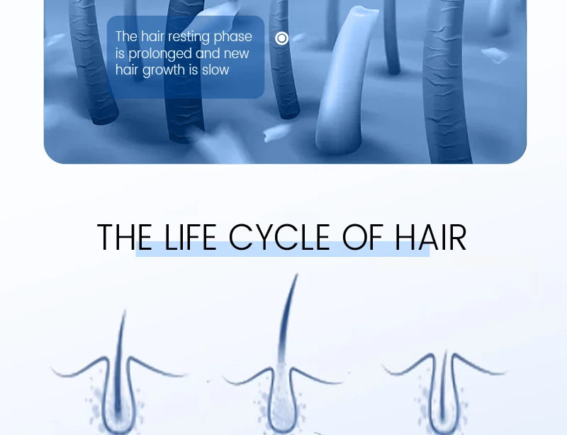 Rosemary Hair Growth Serum Anti Hair Loss Prevent Baldness Hair Care Essential Oil Scalp Treatment Beauty Health Care Men Women
