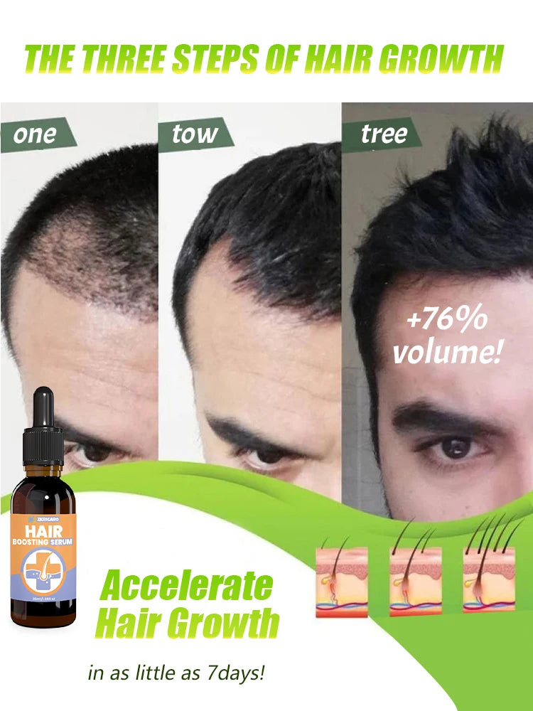 Rosemary Hair Growth Serum Anti Hair Loss Prevent Baldness Hair Care Essential Oil Scalp Treatment Beauty Health Care Men Women