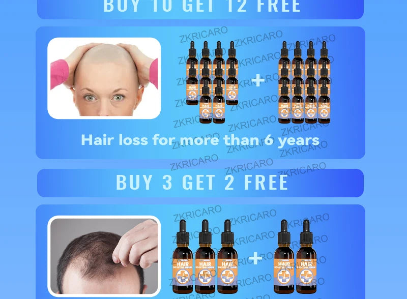 Rosemary Hair Growth Serum Anti Hair Loss Prevent Baldness Hair Care Essential Oil Scalp Treatment Beauty Health Care Men Women