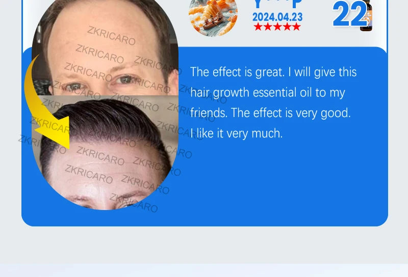 Rosemary Hair Growth Serum Anti Hair Loss Prevent Baldness Hair Care Essential Oil Scalp Treatment Beauty Health Care Men Women