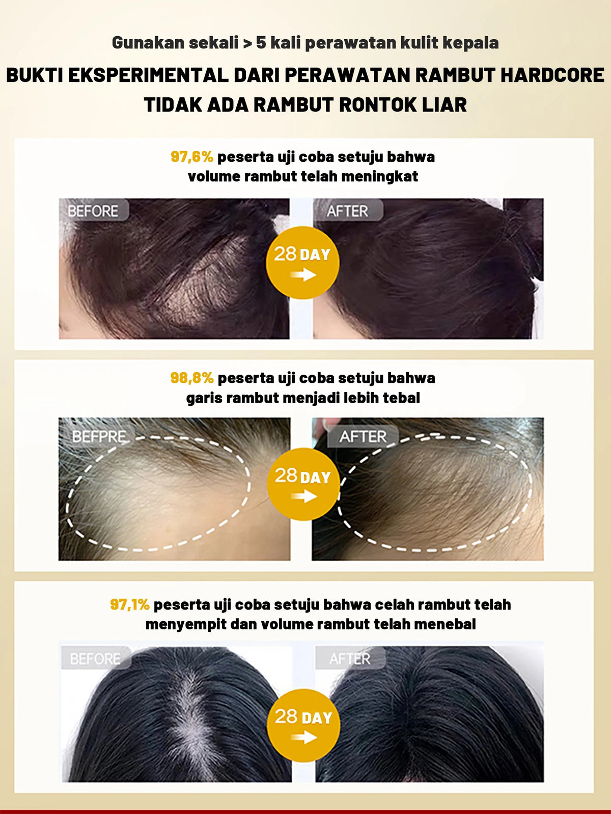 Rosemary Hair Growth Serum Anti Hair Loss Prevent Baldness Hair Care Essential Oil Scalp Treatment Beauty Health Care Men Women