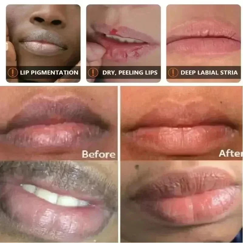 Remove Dark Lip Oil Lightening Melanin Mask Gloss Exfoliating Clean Moisturizer Korean Care SADOER Makeup Beauty Health Products