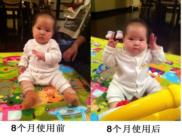 Neck Support Baby Oblique Neck Brace Baby Head Tilt Correct Neck Waibo Kids Neck Protection Lightweight Summer Breathable
